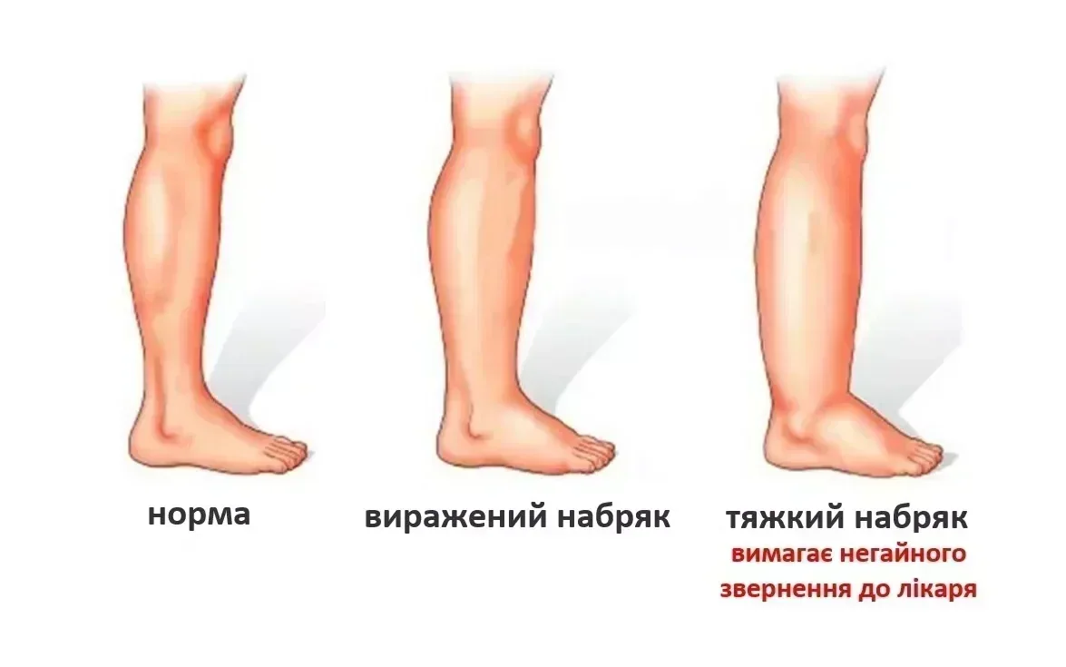 Судинна хірургія